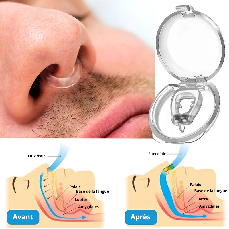 Anti-snoring device for women and men.