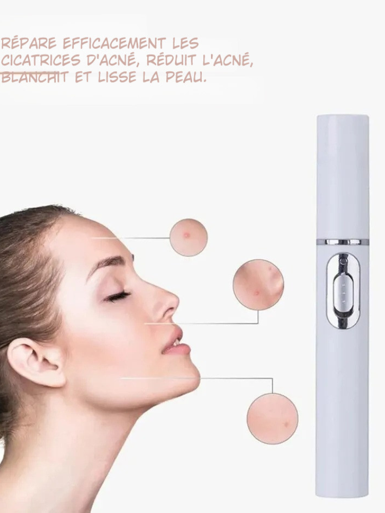Stylo LED Anti-Acné & Soins du Visage